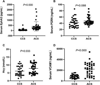 Homocysteine Impairs Endothelial Cell Barrier Function and Angiogenic Potential via the Progranulin/EphA2 Pathway